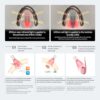 KAISAR Male Urinary Wearable Device Using red Light and Near-Infrared Light - Image 3